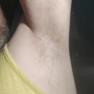 AI Video: The carnivorous fly is biting my armpit plucking out hairs